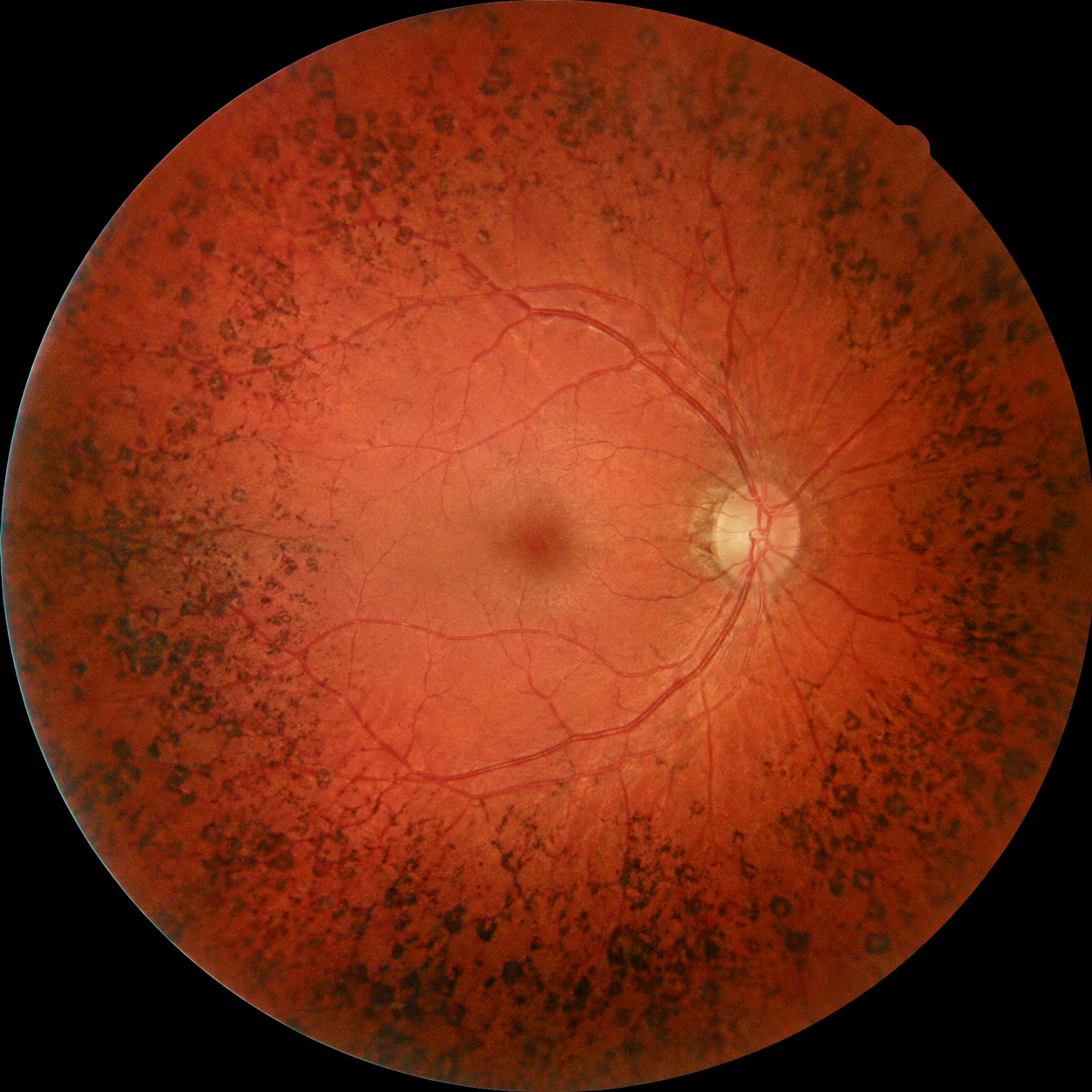 fundus image